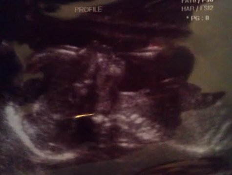 Baby number 2, in profile.